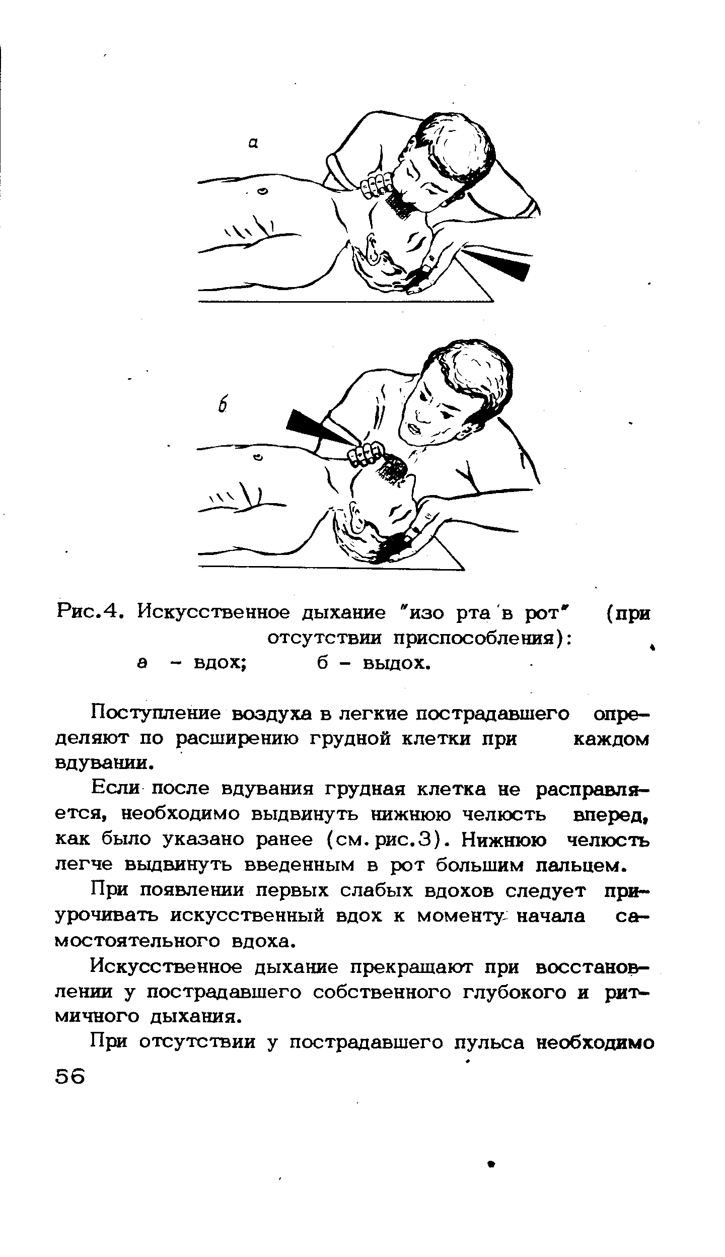 Как делать искусственное дыхание. Схема искусственного дыхания рот в рот. Техника искусственного дыхания изо рта в нос. Методика искусственного дыхания рот ко рту.